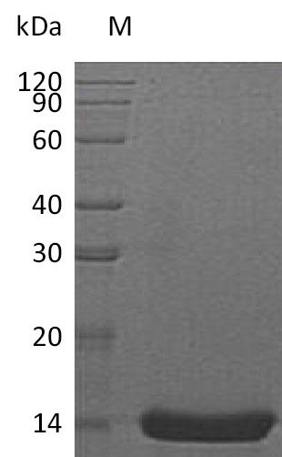 Recombinant Human Interleukin-22(IL22),partial (Active)
