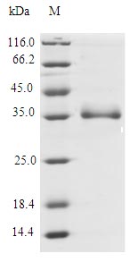 Recombinant Human Interleukin-26(IL26)