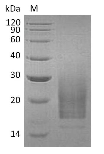 Recombinant Human Interleukin-3(IL3) (Active)