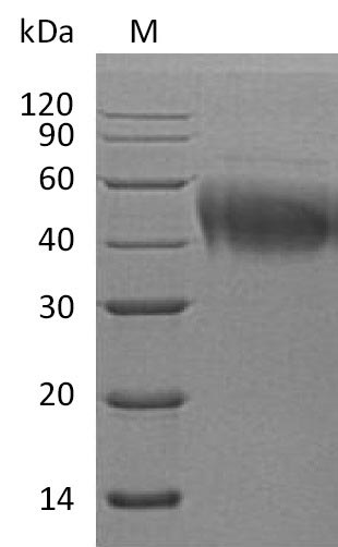 Recombinant Human Interleukin-4 receptor subunit alpha(IL4R),partial (Active)