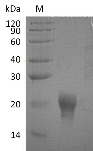 Recombinant Human Interleukin-5(IL5) (Active)