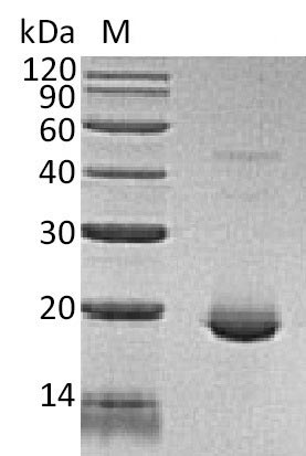 Recombinant Human Interleukin-6(IL6),partial (Active)