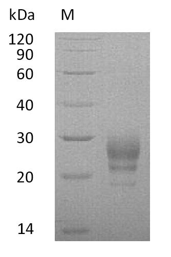 Recombinant Human Interleukin-7(IL7) (Active)