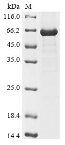 Recombinant Human Intestinal-type alkaline phosphatase(ALPI)