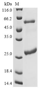 Recombinant Human Isoleucine--tRNA ligase, cytoplasmic(IARS),partial