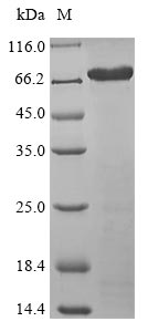 Recombinant Human Isthmin-1(ISM1)