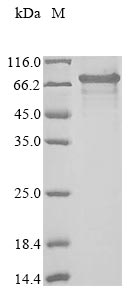 Recombinant Human Isthmin-2(ISM2),partial