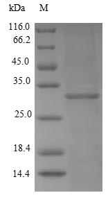 Recombinant Human Kallikrein-2(KLK2)