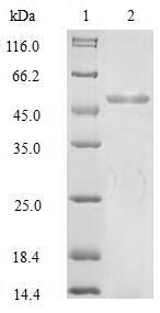 Recombinant Human KeRatin, type I cytoskeletal 18(KRT18),partial
