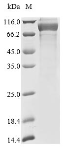 Recombinant Human Keratin, type I cuticular Ha4(KRT34)