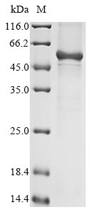 Recombinant Human Keratin, type I cuticular Ha4(KRT34)