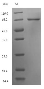 Recombinant Human Keratin, type I cuticular Ha5(KRT35)