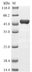 Recombinant Human Keratin, type I cytoskeletal 18(KRT18)