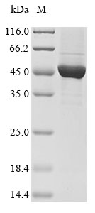 Recombinant Human Keratin, type I cytoskeletal 18(KRT18)