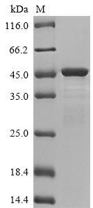 Recombinant Human Keratin, type I cytoskeletal 19(KRT19)