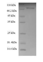 Recombinant Human Keratin,type II cytoskeletal 8(KRT8)