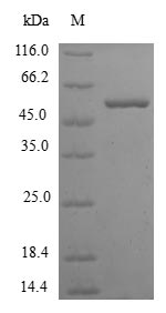 Recombinant Human Ketohexokinase(KHK)
