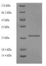 Recombinant Human Killer cell immunoglobulin-like receptor 2DS1(KIR2DS1),partial