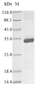 Recombinant Human Killer cell immunoglobulin-like receptor 2DS3(KIR2DS3),partial