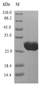 Recombinant Human Kita-kyushu lung cancer antigen 1(CT83)