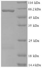 Recombinant Human Kynurenine--oxoglutarate transaminase 1(KYAT1)