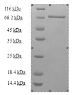 Recombinant Human Kynurenine--oxoglutarate transaminase 3(CCBL2)