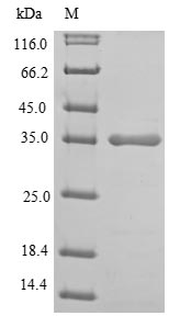 Recombinant Human L-lactate dehydrogenase A chain(LDHA),partial