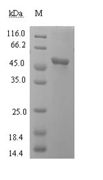 Recombinant Human L-lactate dehydrogenase C chain(LDHC)