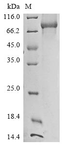 Recombinant Human Lanosterol synthase(LSS)