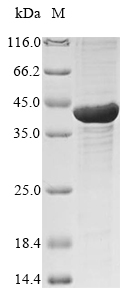 Recombinant Human Left-right determination factor 2(LEFTY2)