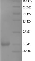 Recombinant Human Leptin(LEP),partial
