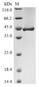 Recombinant Human Leucine-rich glioma-inactivated protein 1(LGI1),partial