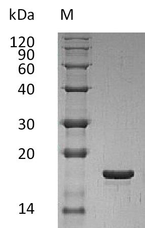 Recombinant Human Leukemia inhibitory factor(LIF) (Active)