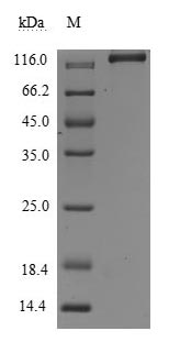 Recombinant Human Leukemia inhibitory factor receptor(LIFR),partial (Active)