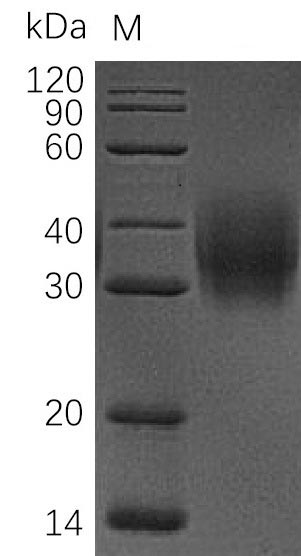 Recombinant Human Leukocyte surface antigen CD47(CD47),partial (Active)