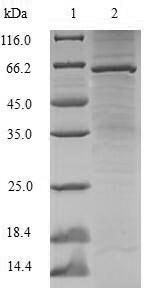 Recombinant Human Lupus La protein(SSB)