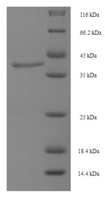 Recombinant Human Lutropin-choriogonadotropic hormone receptor(LHCGR),partial
