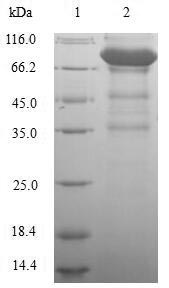 Recombinant Human Lymphocyte activation gene 3 protein(LAG3),partial