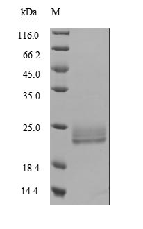Recombinant Human Lymphotoxin-alpha(LTA) (Active)