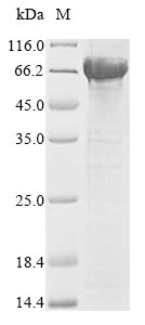 Recombinant Human Lysosomal acid glucosylceramidase(GBA)