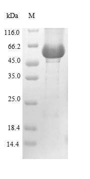 Recombinant Human Lysosomal acid glucosylceramidase(GBA)