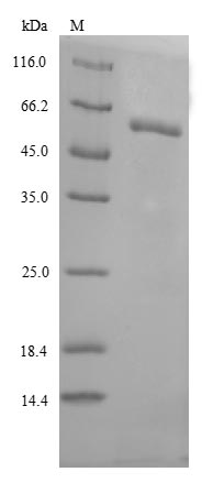 Recombinant Human Lysosomal acid glucosylceramidase(GBA)