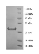 Recombinant Human Lysozyme C(LYZ)