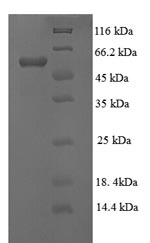 Recombinant Human Lysyl oxidase homolog 1(LOXL1),partial