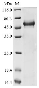 Recombinant Human Lysyl oxidase homolog 3(LOXL3),partial