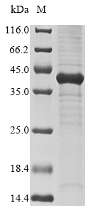 Recombinant Human MIG7(MIG7)