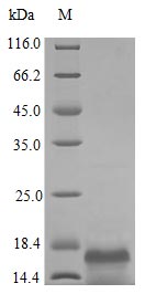 Recombinant Human Macrophage colony-stimulating factor 1 protein(CSF1),partial (Active)