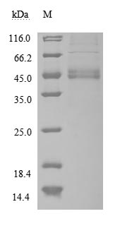 Recombinant Human Macrophage migration inhibitory factor(MIF) (Active)