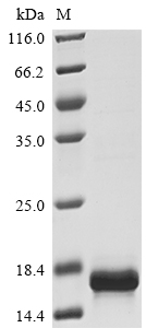 Recombinant Human Macrophage migration inhibitory factor(MIF)