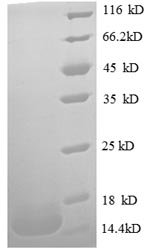 Recombinant Human Macrophage migration inhibitory factor(MIF)